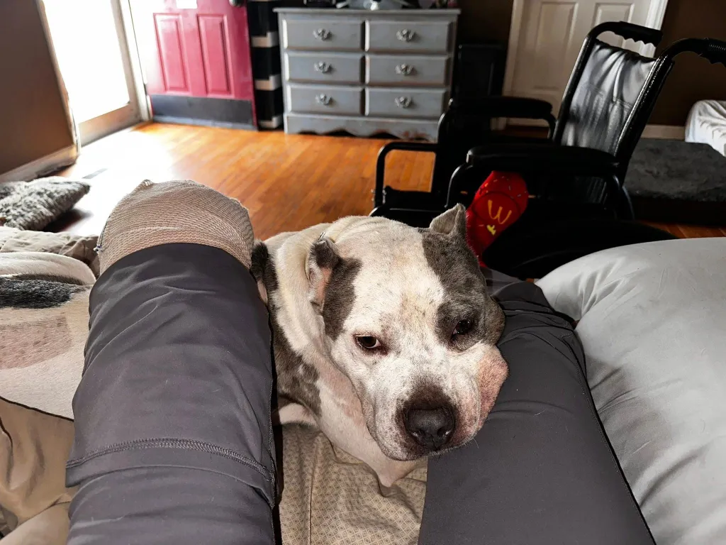 A person with an amputated leg, covered in a bandage, and a dog resting between their legs.