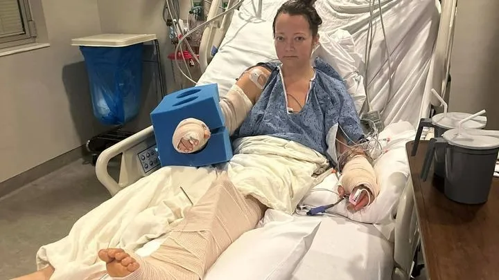 A woman with multiple bandages and medical equipment on her arms and leg lies in a hospital bed.