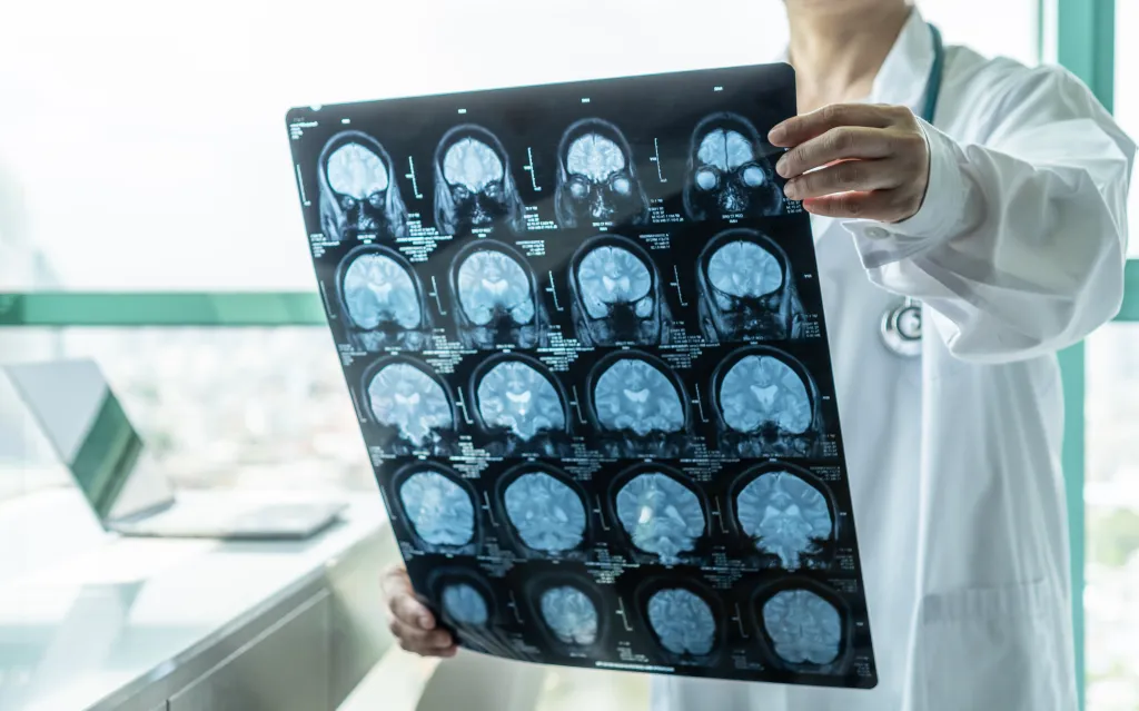 new research has uncovered further evidence that this diet could negatively impact the brain.