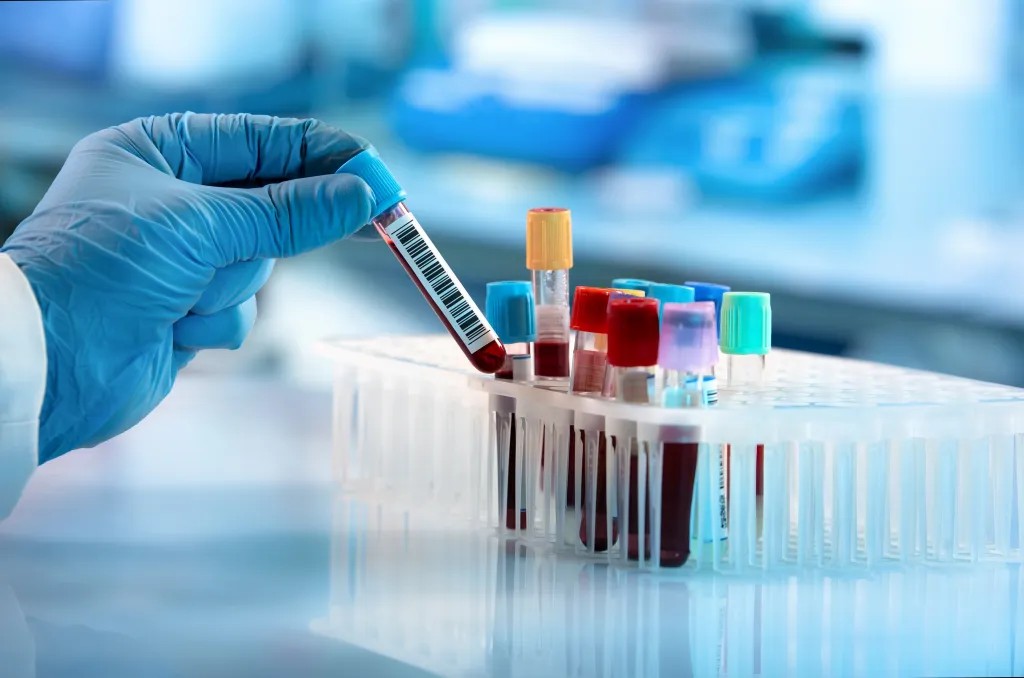 Lab technician holding a blood tube sample for study.
