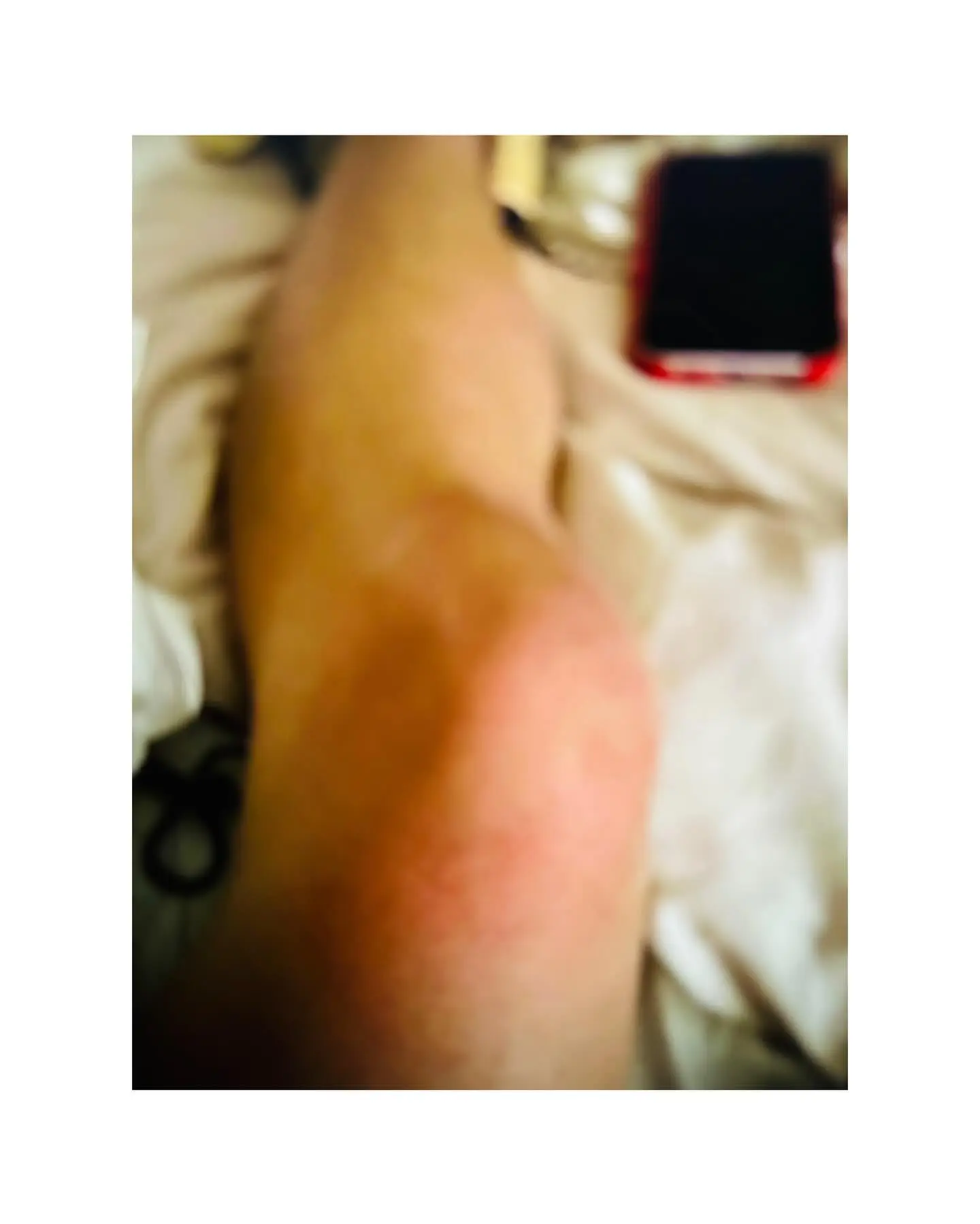 A blurred photo of Britney Spears' leg and knee.