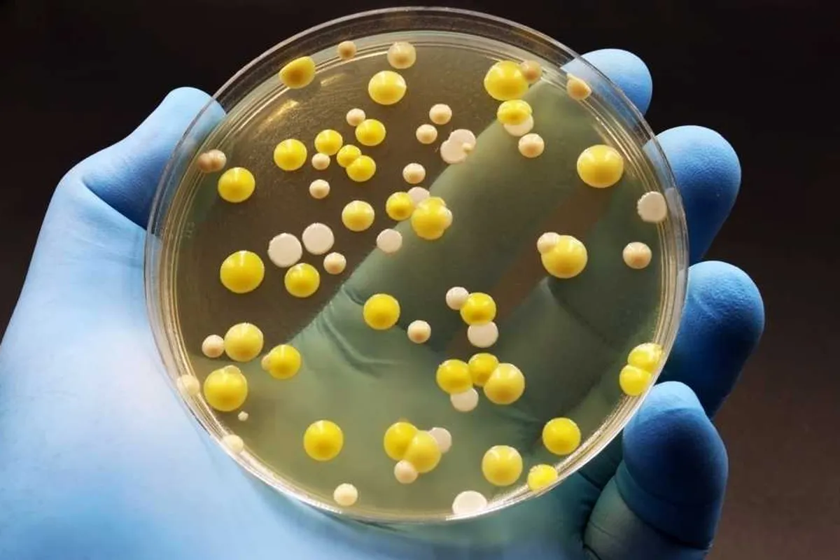 Scientists warn climate-driven droughts may be worsening spread of superbugs