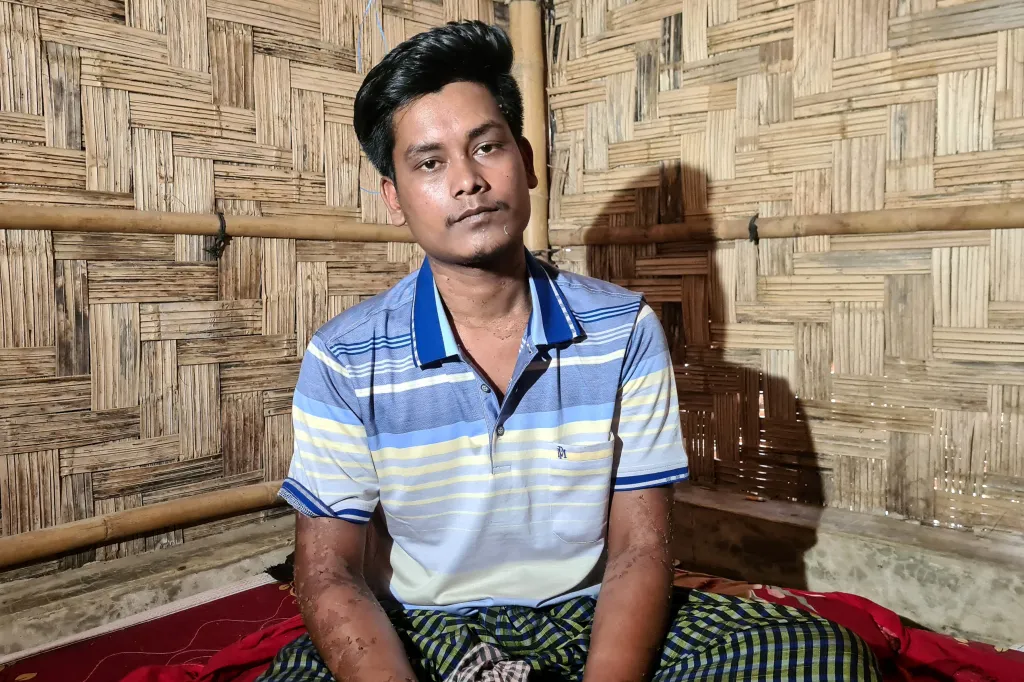 A boat capsize survivor, a young man with skin lesions, sits in a refugee camp shelter.