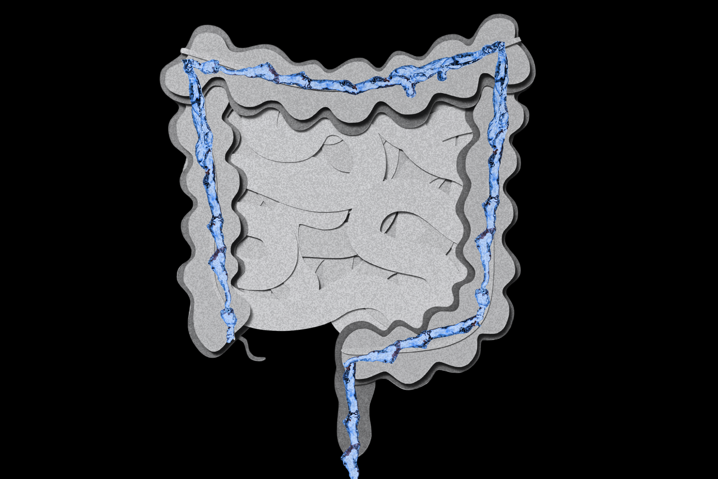 Is Colon Hydrotherapy Safe? Here’s What Medical Experts Say