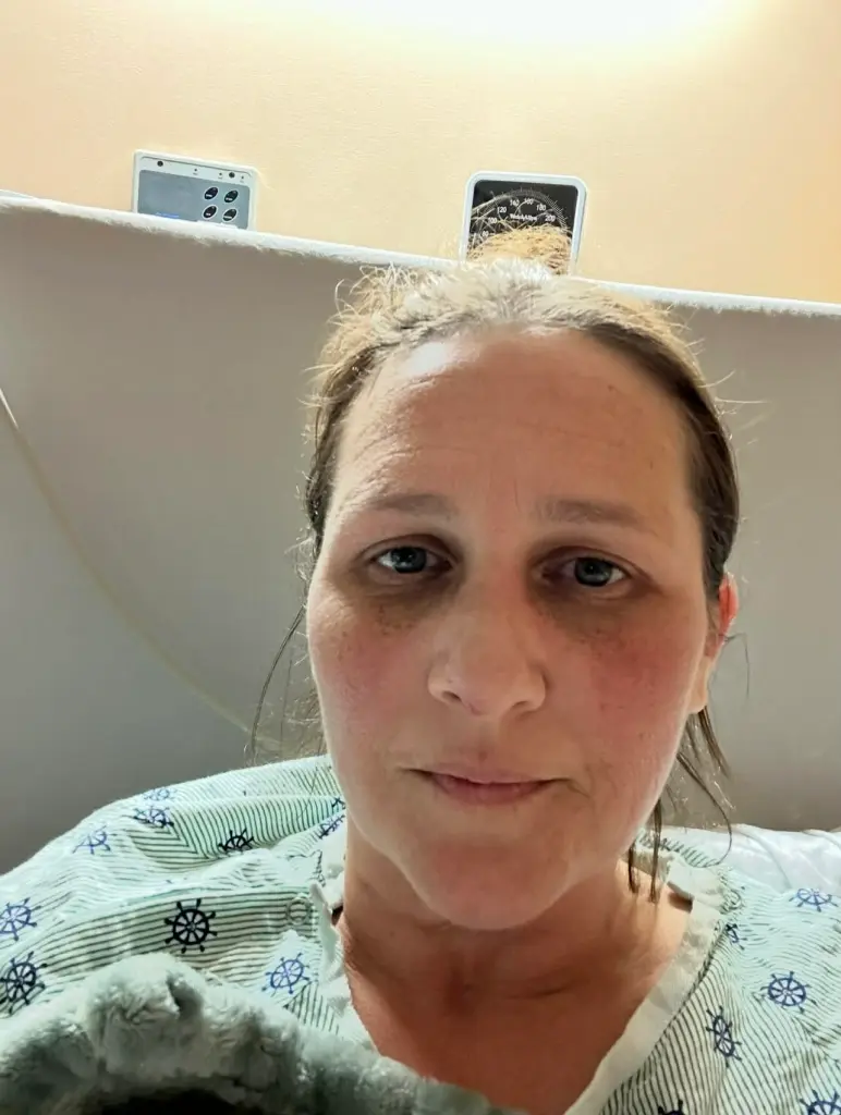 A woman with dark circles under her eyes, wearing a hospital gown, looks directly at the camera.