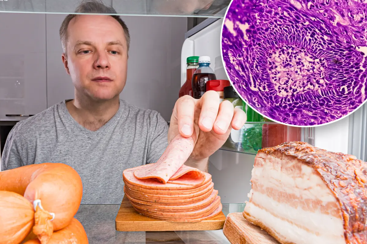 One extra serving of processed meat a day linked to higher cancer risk