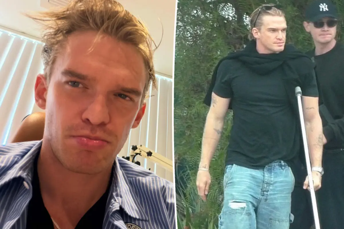 Cody Simpson ‘can’t walk or talk’ after horrifying double injury: ‘I’ll be back stronger’
