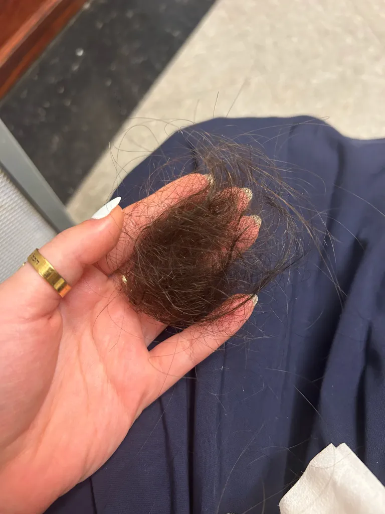 A person's hand holds a large clump of dark hair with white flakes, likely from being pulled out during an assault.