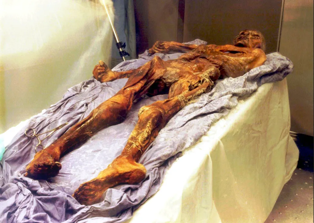 The 5,300-year-old mummy known as "Oetzi" lies on a draped table in the Archeology Museum in Bolzano.