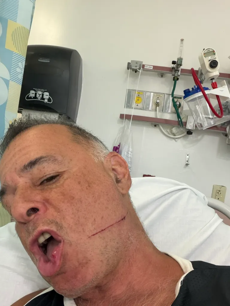 A man with a visible cut on his neck, appearing injured.