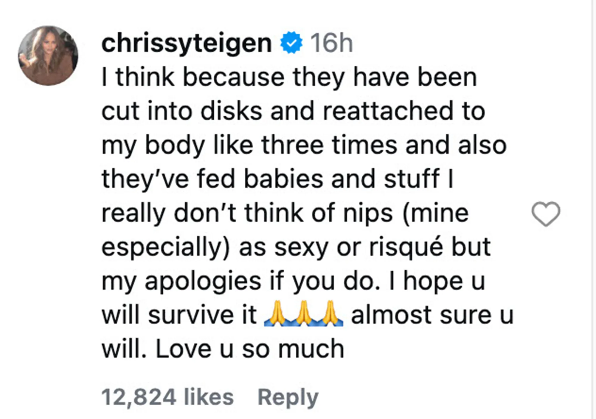 Chrissy Teigen defends showing off her breasts in a sheer top
