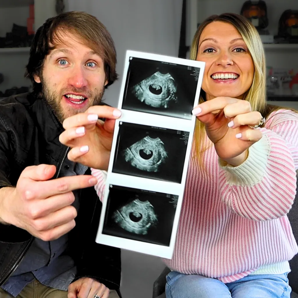 A man and a woman holding up a strip of three ultrasound images.