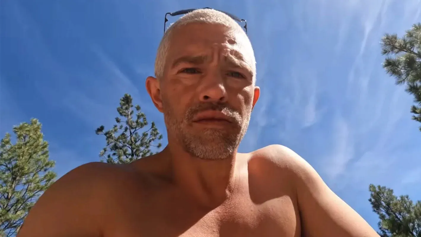 Matt Brown with a worried expression, under a clear sky and pine trees.