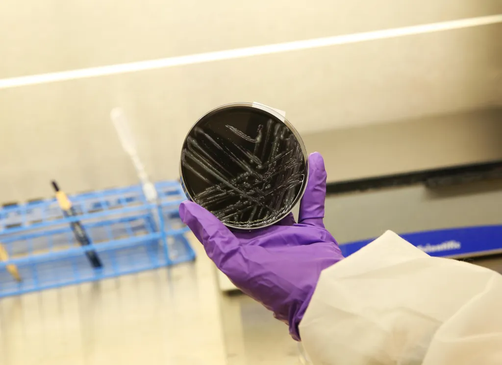 A gloved hand holding a petri dish with Legionella pneumophila bacteria.
