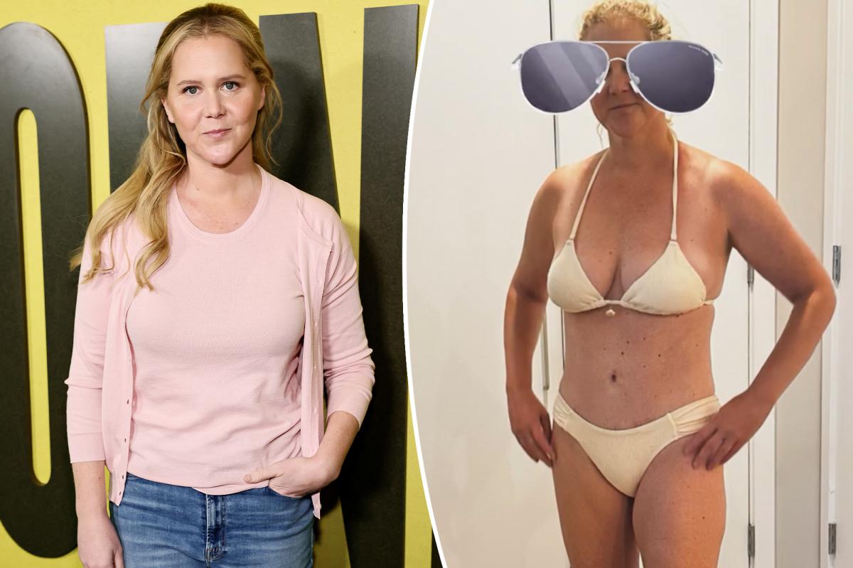 Amy Schumer shows off C-section scar in tiny bikini, boasts that she’s a ‘warrior’