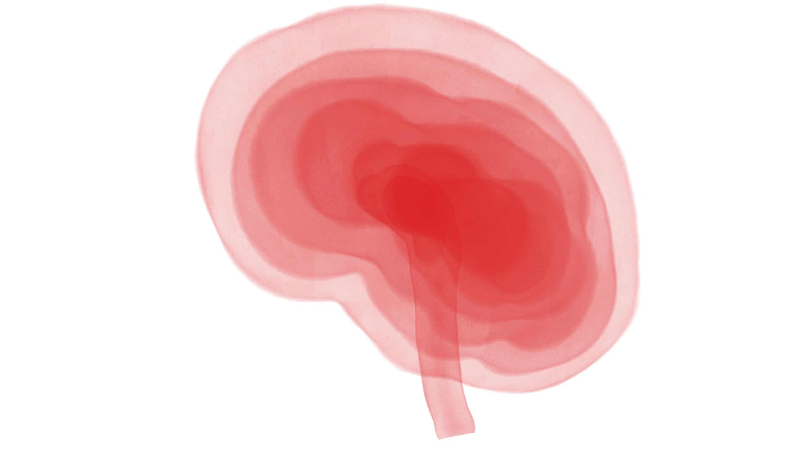 Cognitive Rehabilitation May Help Treat Long Covid, Study Says