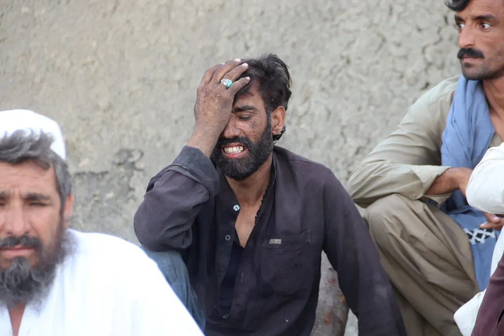 A man with coal dust on his face, eyes closed in pain, and a hand to his head, sits among other men.