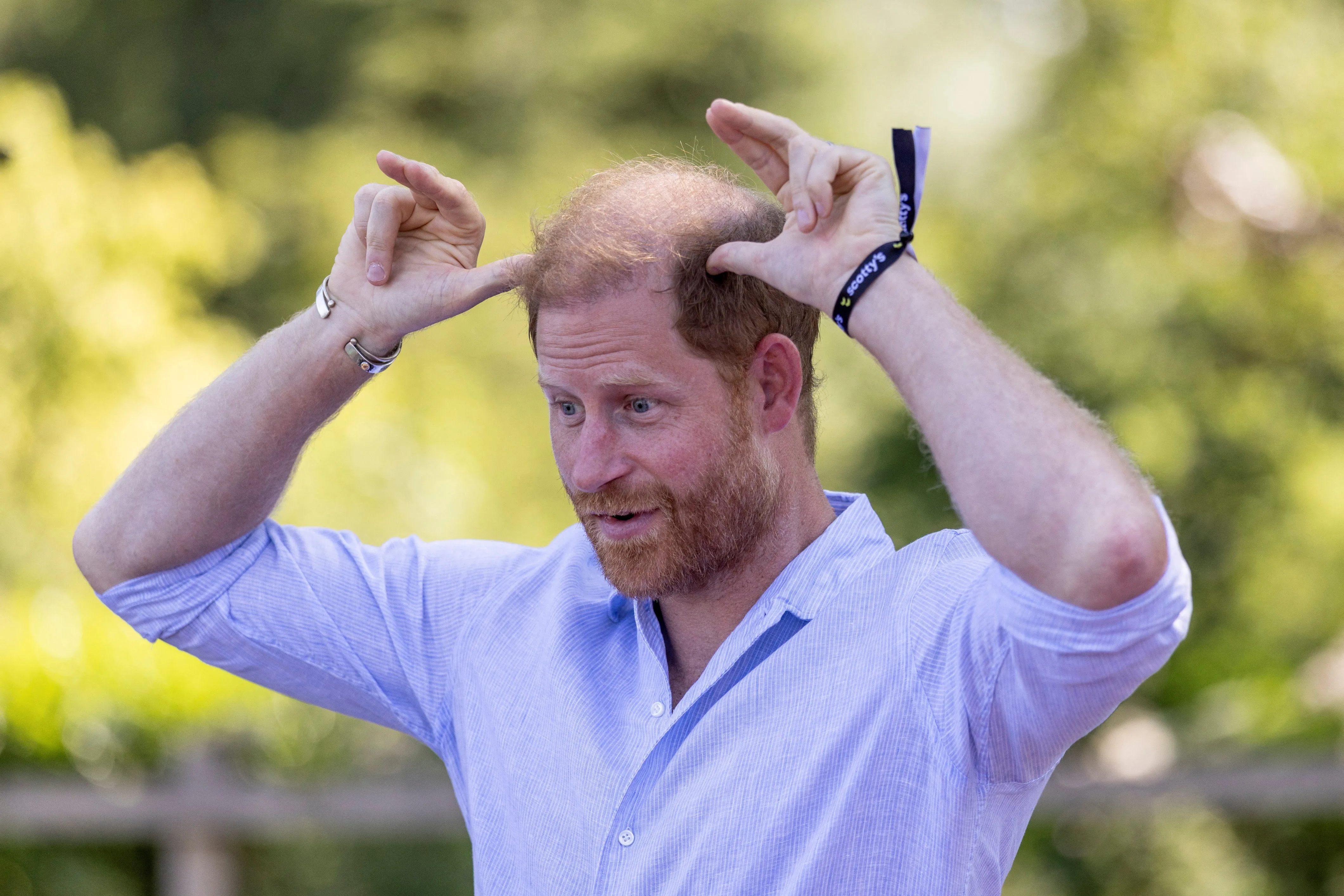 Prince Harry mimics goat horns during Goat Yoga at Scotty's Summer Festival.