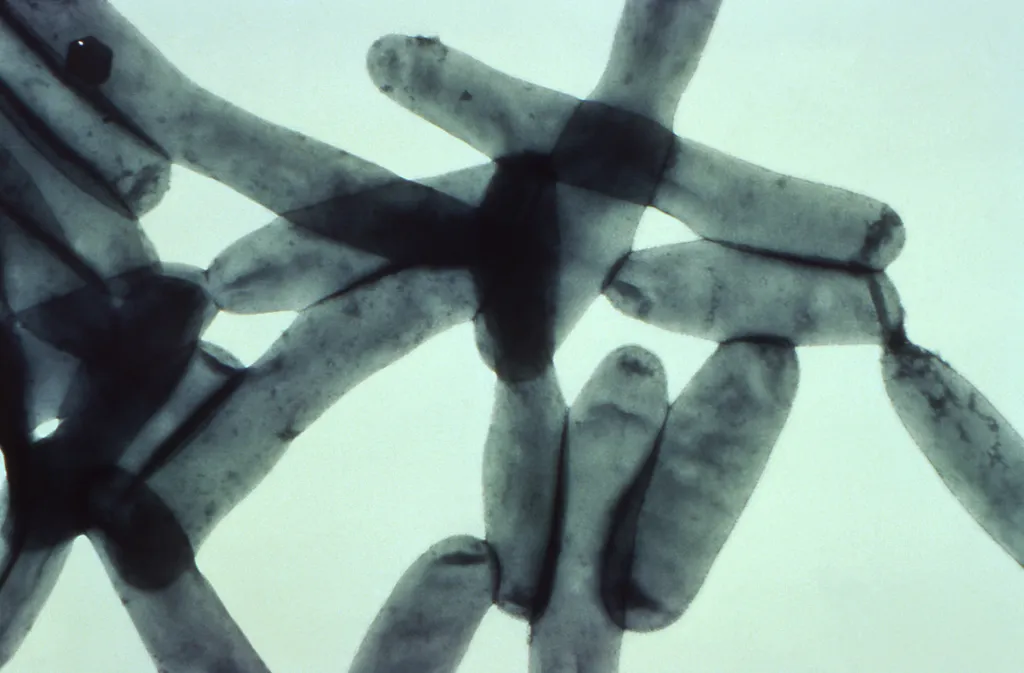 The disease stems from Legionella bacteria that has been found in 76 cooling towers across Upper East Side neighborhood.