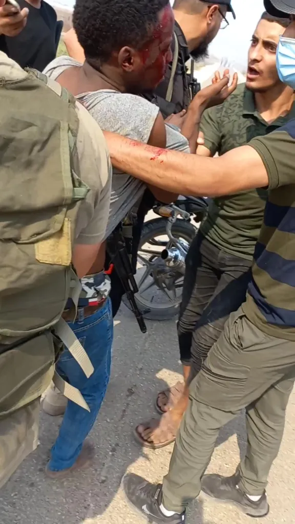 A man with a bloodied face and arm is being held by several other men, one of whom has a rifle tucked into his waistband.