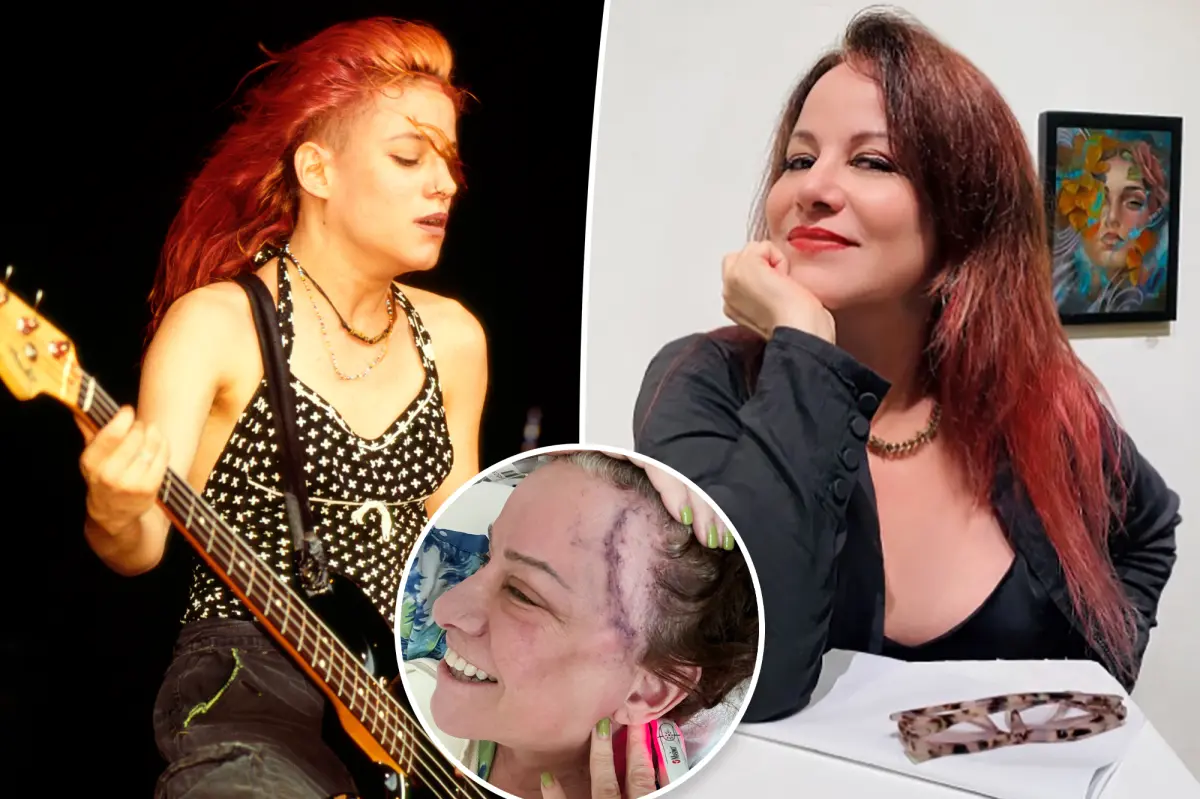L7 rocker Jennifer Finch goes public with aggressive cancer diagnosis, reveals gnarly brain surgery scar