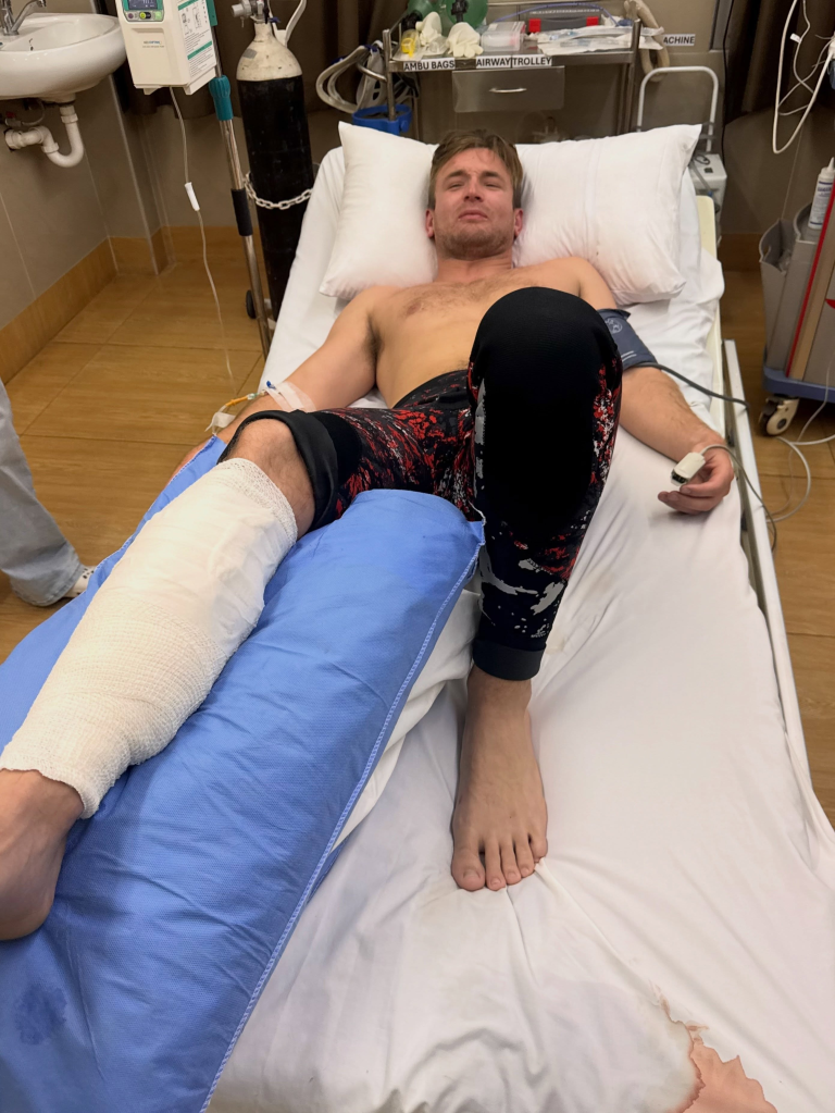 Henry Gibbs in a hospital bed with a bandaged leg after a shark attack.