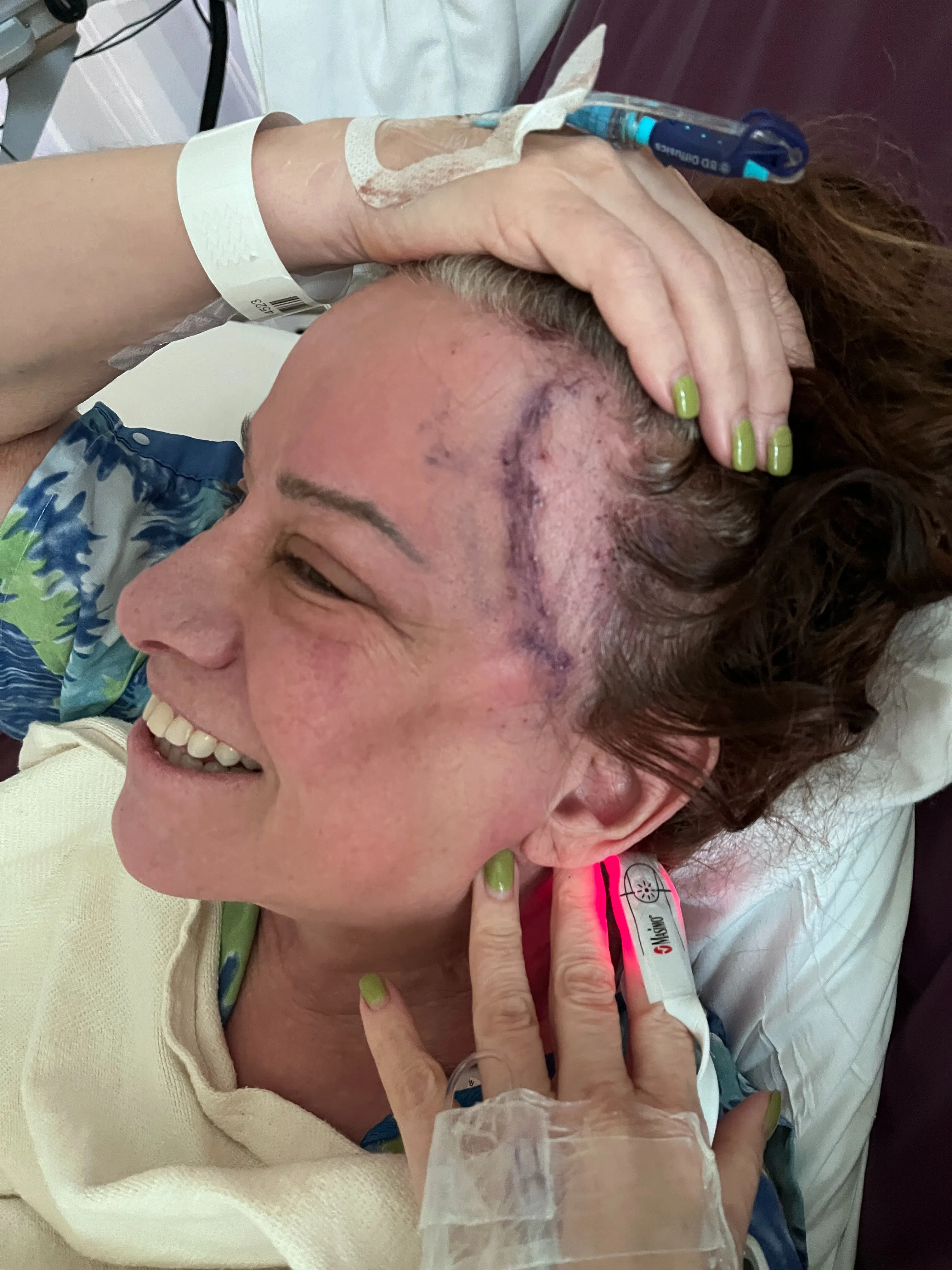 Jennifer Finch in a hospital gown, smiling with an incision scar on her temple, and an IV in her hand.