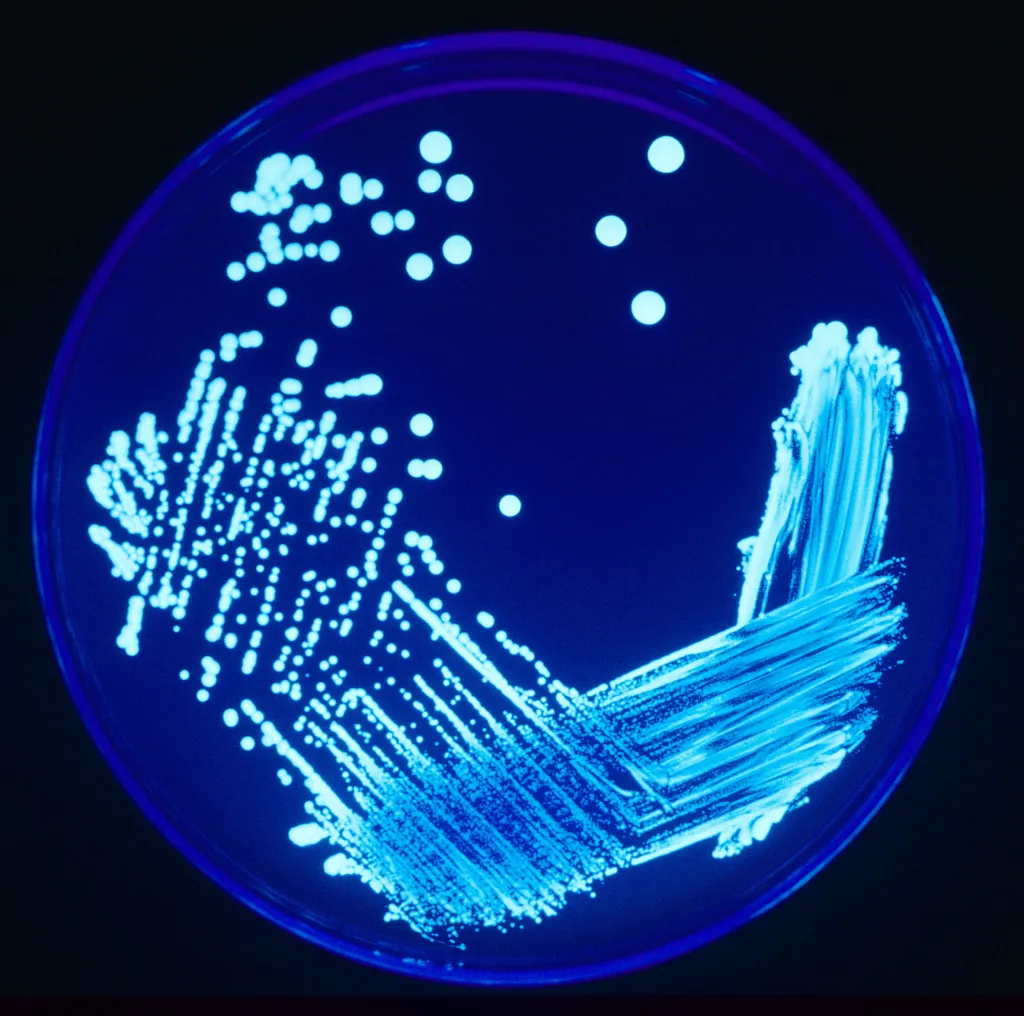 Legionella colonies illuminated by ultraviolet light on an agar plate.