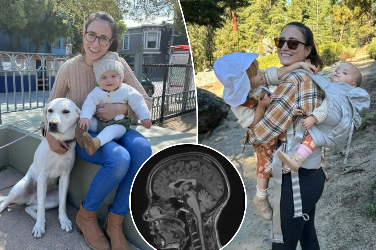 Doctors told me I had anxiety — I was relieved to finally get diagnosed with a brain tumor