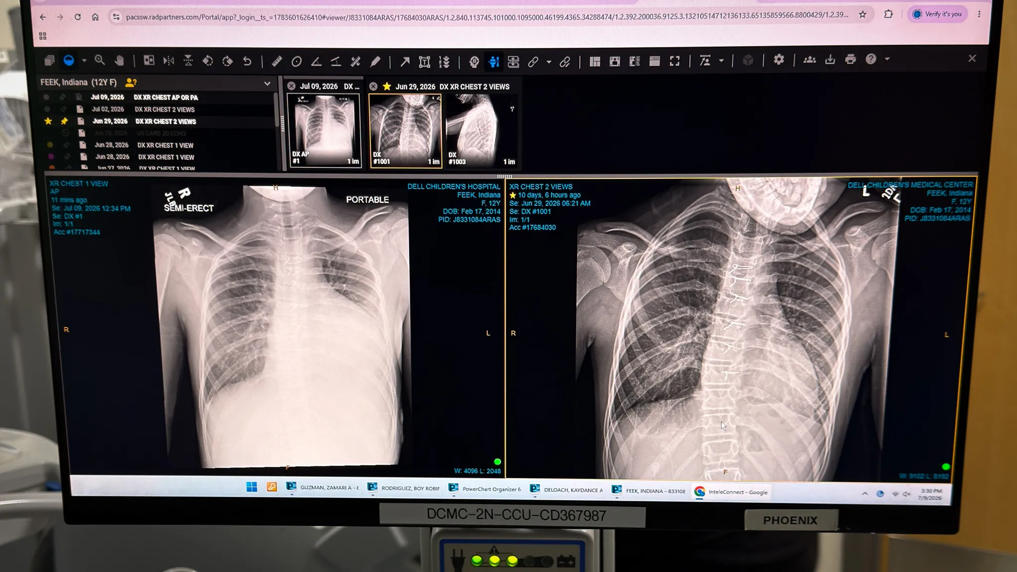 Doctors soon discovered a dangerous buildup of fluid surrounding Indiana's heart that was preventing it from pumping properly, requiring emergency surgery.