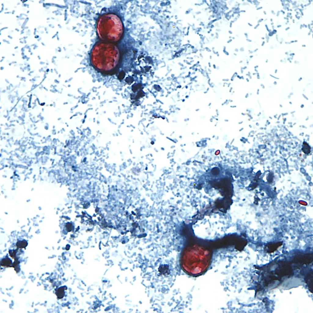 Cyclospora is a microscopic parasite (Cyclospora cayetanensis) that infects the small intestine after people consume contaminated food or water, according to the CDC.