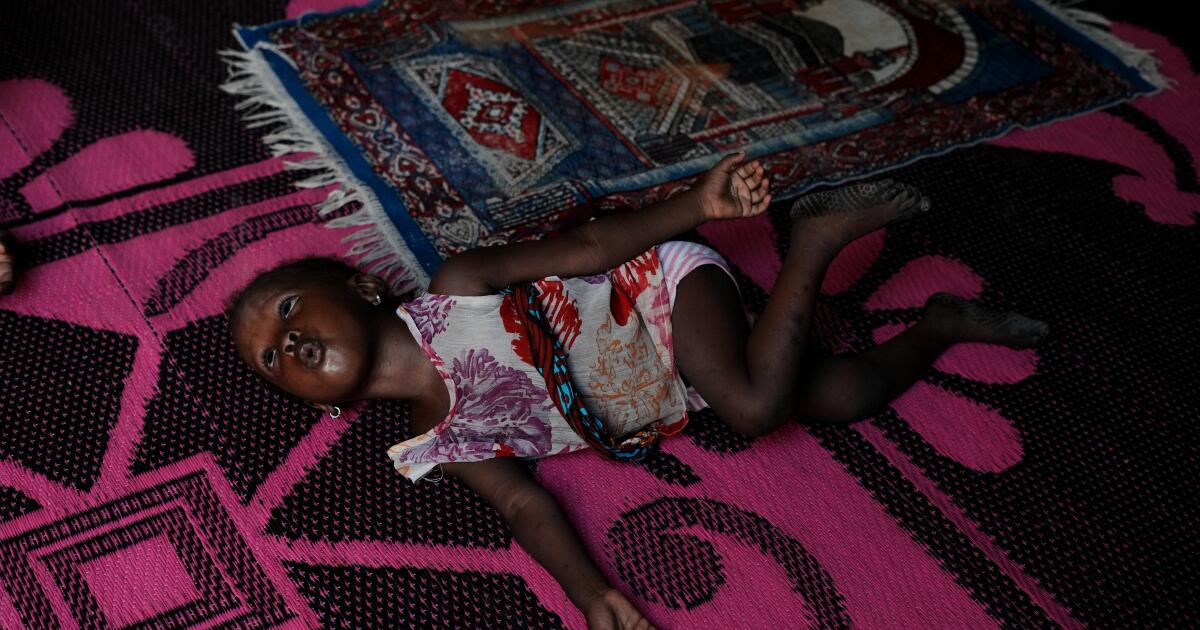 Another effect of the Iran war: Nigerian children suffer as malnutrition and poverty surge