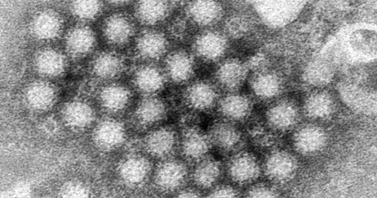 Norovirus outbreak on cruise ship from California sickens more than 100 passengers