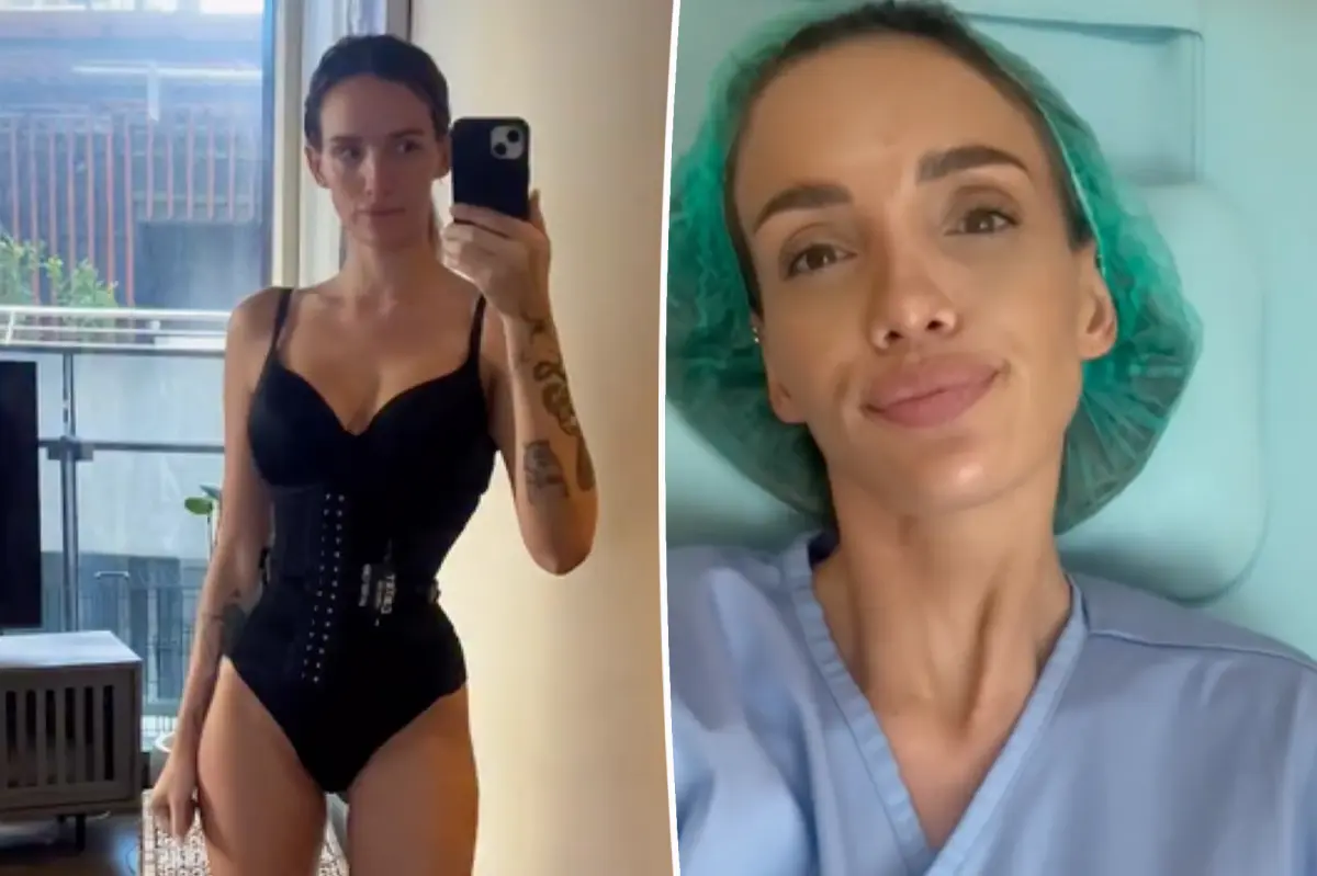 Bravo alum shares results of ‘rib recontouring’ procedure to get ‘snatched waist’: ‘Best thing I’ve done’