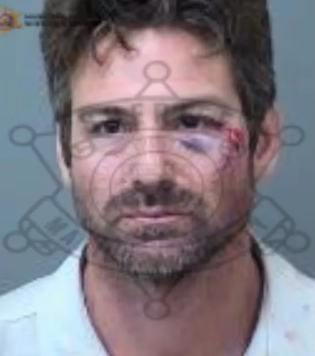 Mugshot of a man with a black eye and bloody scratches on his left cheek.