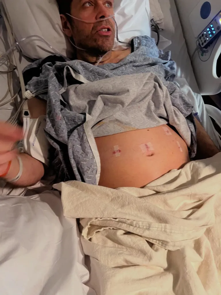 Perez Hilton in a hospital bed with a nasal cannula and bandages on his stomach.