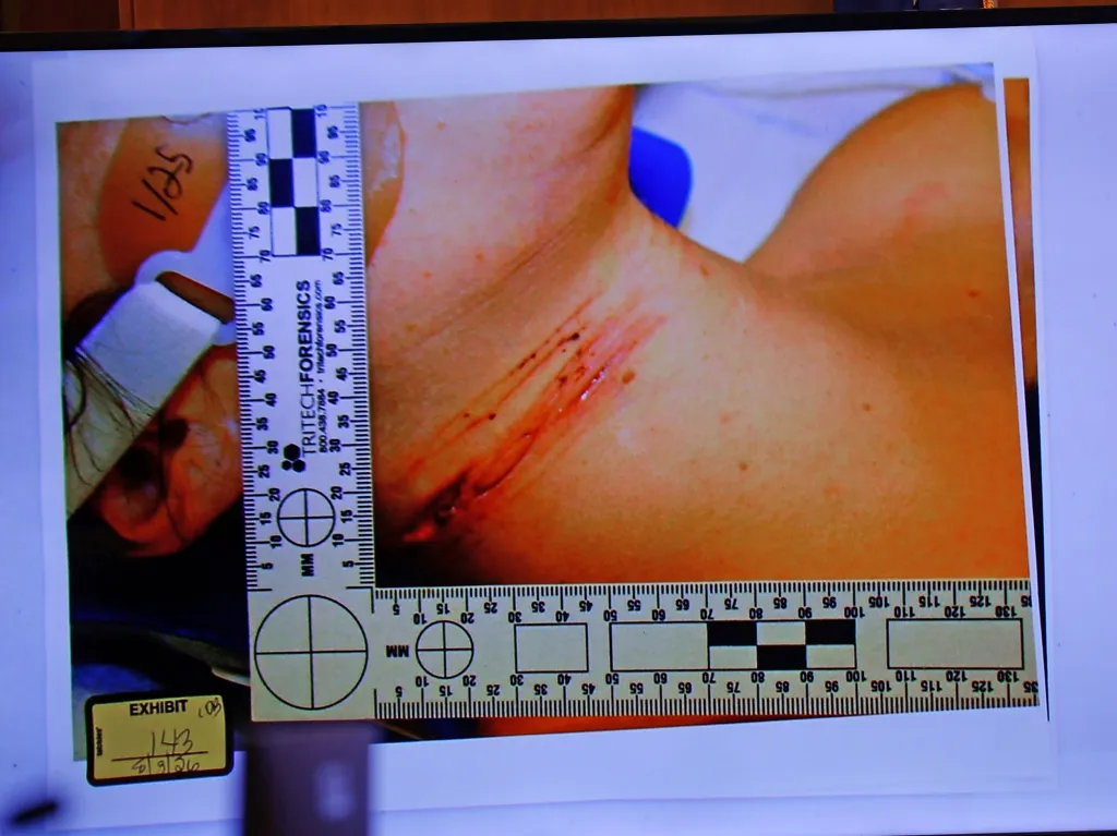 Lindsay Clancy's neck wounds